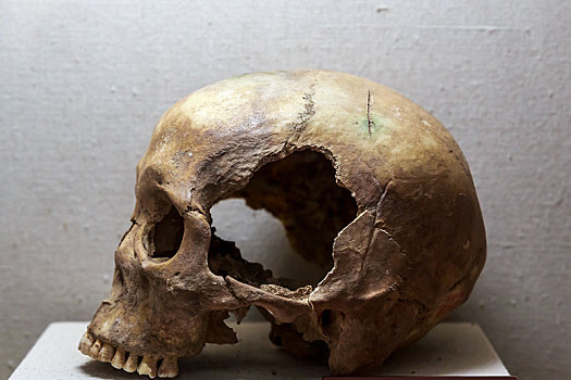 中国河南省安阳殷墟出土文物受伤士兵的头骨和肱骨