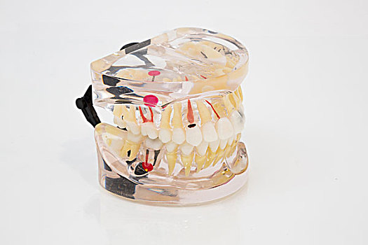 塑料制品,模型,人,假牙