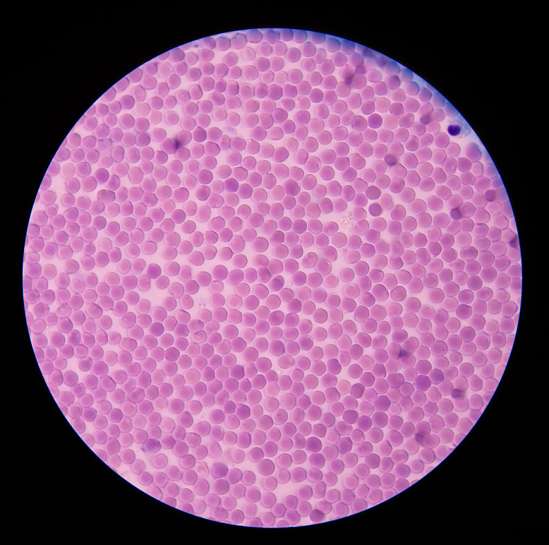 红血球,显微镜_高清图片_全景视觉