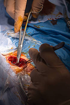 解剖手术 男子图片