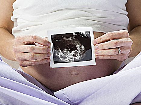 特写,怀孕,腹部,超声波,照相