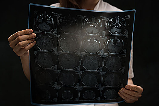 博士,注视,核磁共振成像,x光,大脑