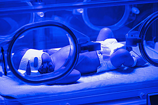 婴儿,早产儿保育器,蓝光,医院,艾伯塔省,加拿大