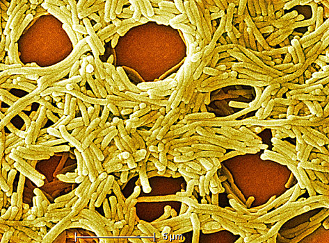 电子显微图,细菌
