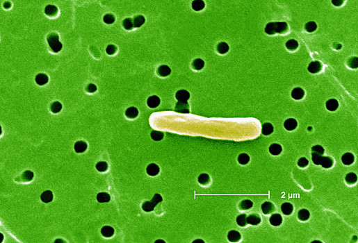 细菌的样子放大图片图片