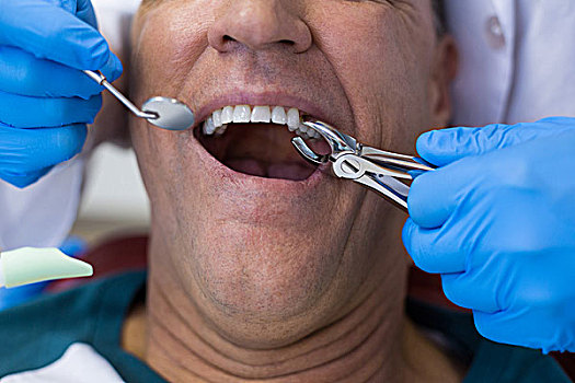 牙医,外科,钳子,衰败,牙齿,诊所