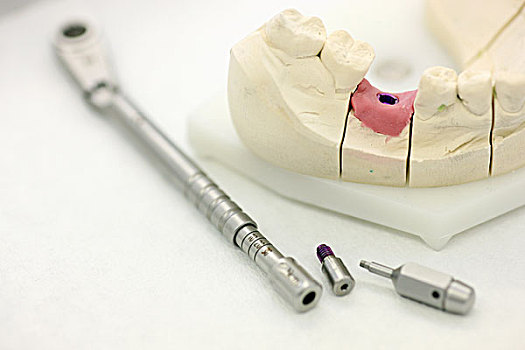 牙齿,移植,器具