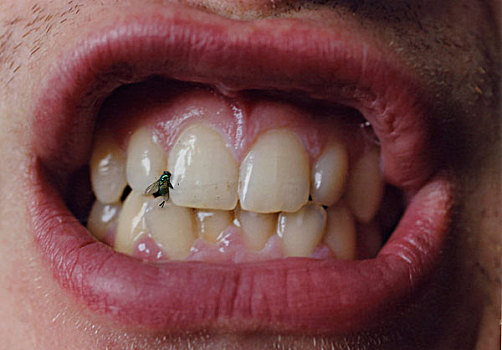 飞虫,牙齿