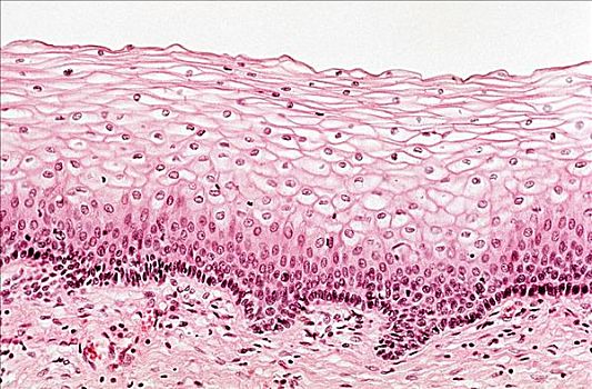 复层柱状上皮细胞图片