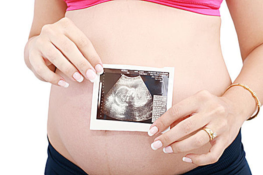 怀孕,女人,腹部,超声波,上方,白色背景
