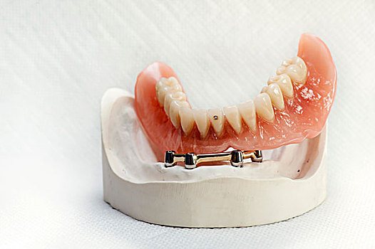 牙齿,颚部,模型