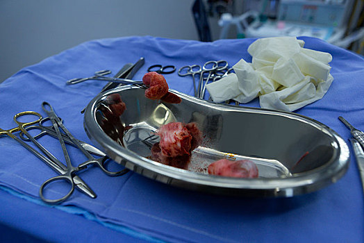 手术工具,肾脏,盘子,桌子,手术,房间,医院