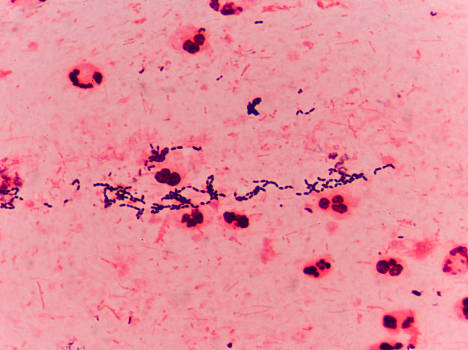 革兰染色阳性球菌图片