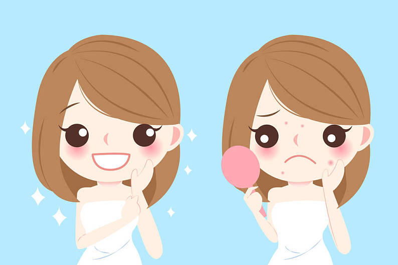 卡通_女人_痤疮_高清图片_全景视觉