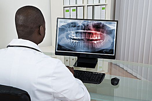 牙医,看,牙齿,x光,电脑