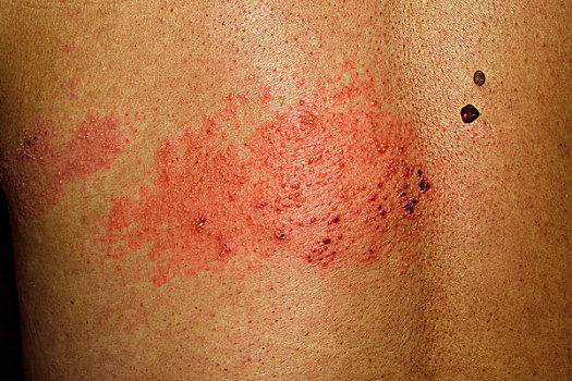 痣,山,蛋糕,红色,去壳谷粒女孩,听,耳机,地毯鸡肉,巧克力酱