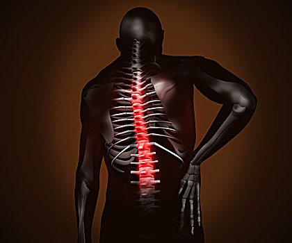 黑色,数码,男人,背痛,突显,脊椎