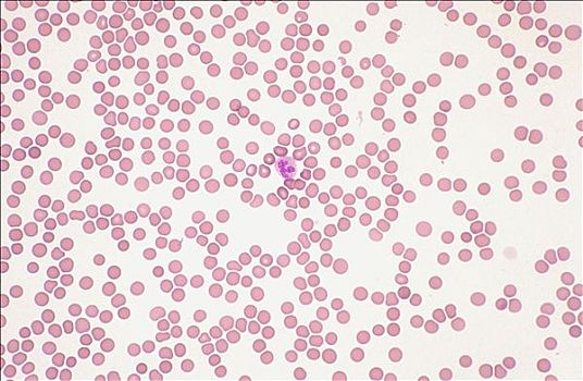 组织学,血细胞,红血球