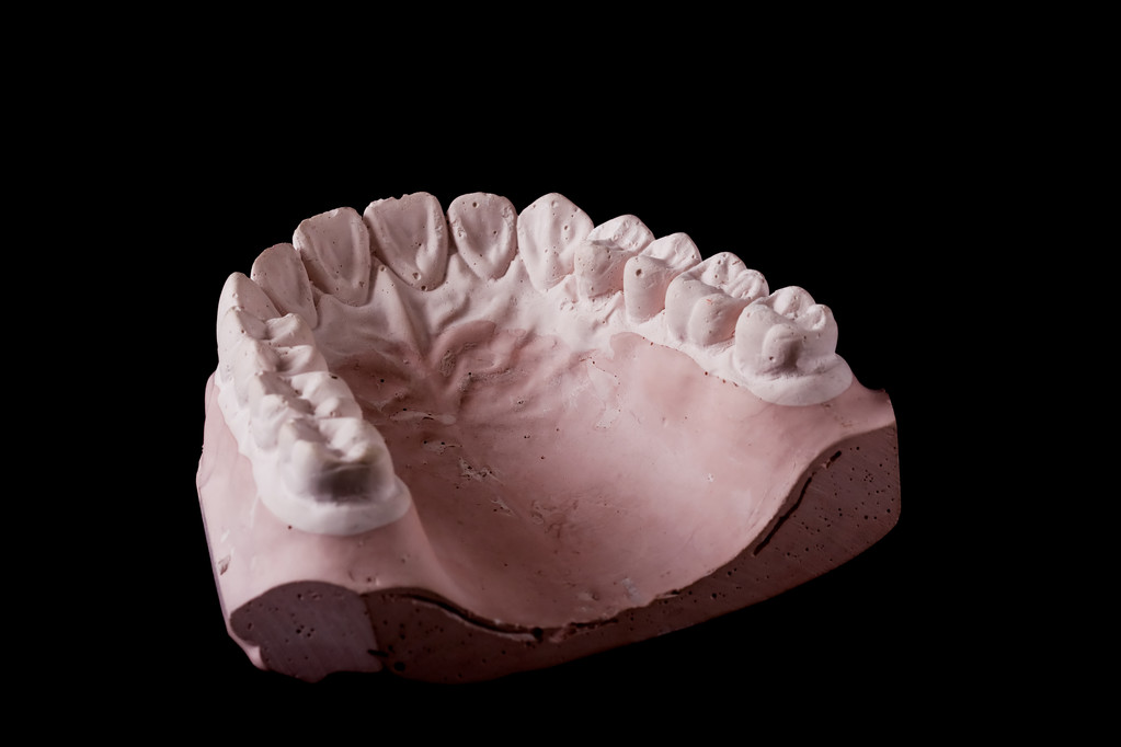 中切牙石膏模型图片