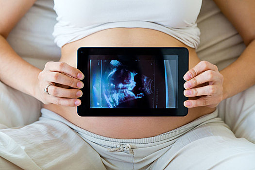 孕妇,拿着,超声波扫描,肚子