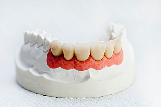 人造,牙齿,颚部,模型