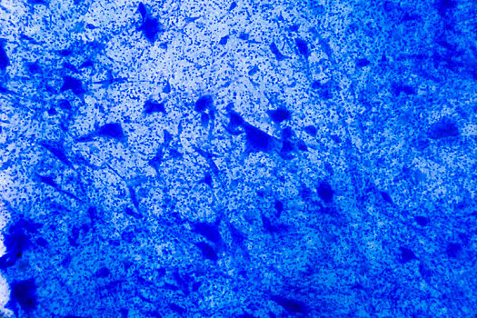 神经,细胞,显微镜,抽象,蓝色,圆点,白色背景,背景