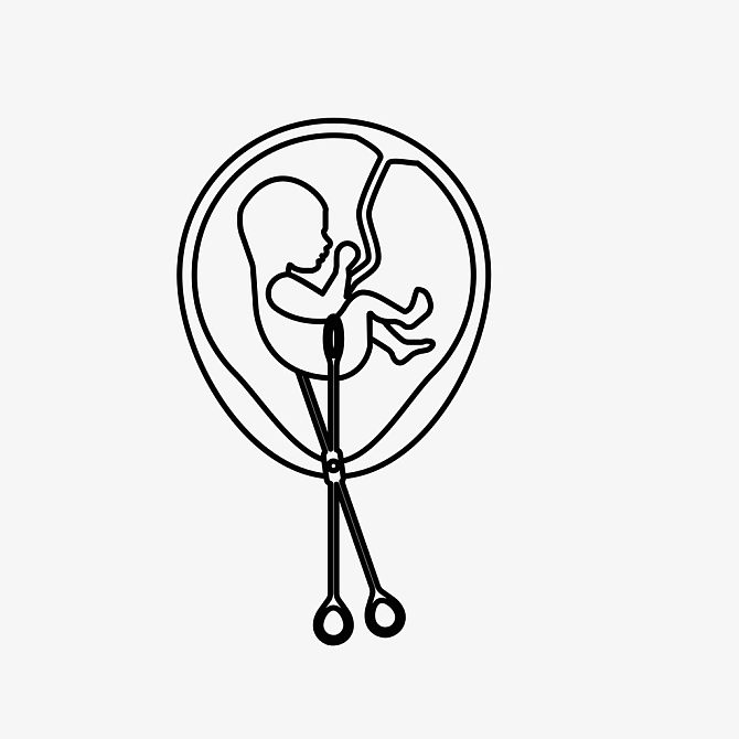 决定,胚胎,插画_高清图片_全景视觉