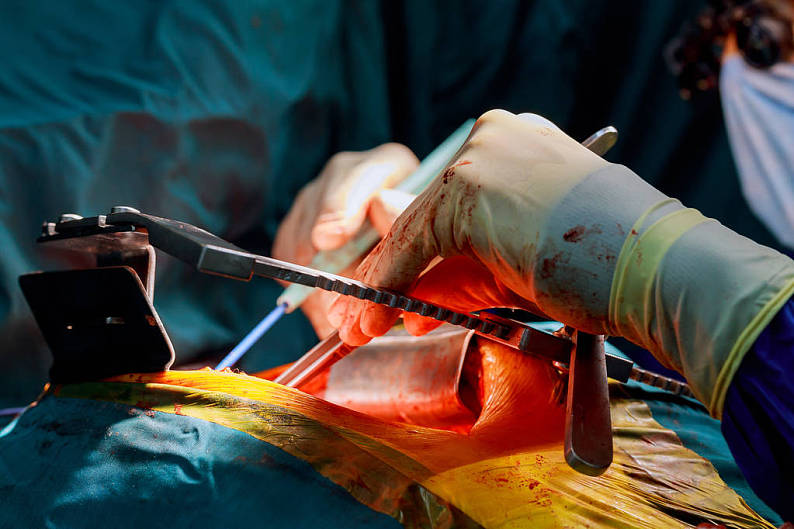 跳动_心脏_特写_胸部_外科手术_心_高清图片_全景视觉