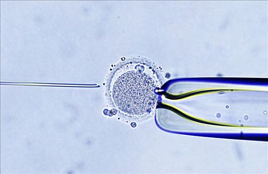 繁殖,注射,精子,卵细胞