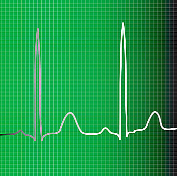 绿色,心电图,显示器,心脏,心率,信息