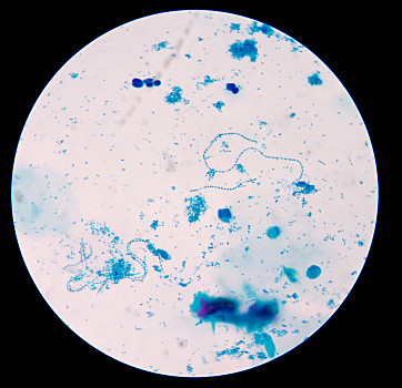 八叠球菌显微镜下图片图片
