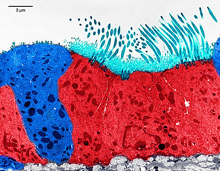 传送,电子,显微照片,上皮细胞