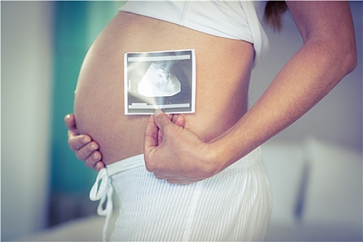 腹部,孕妇,超声波扫描
